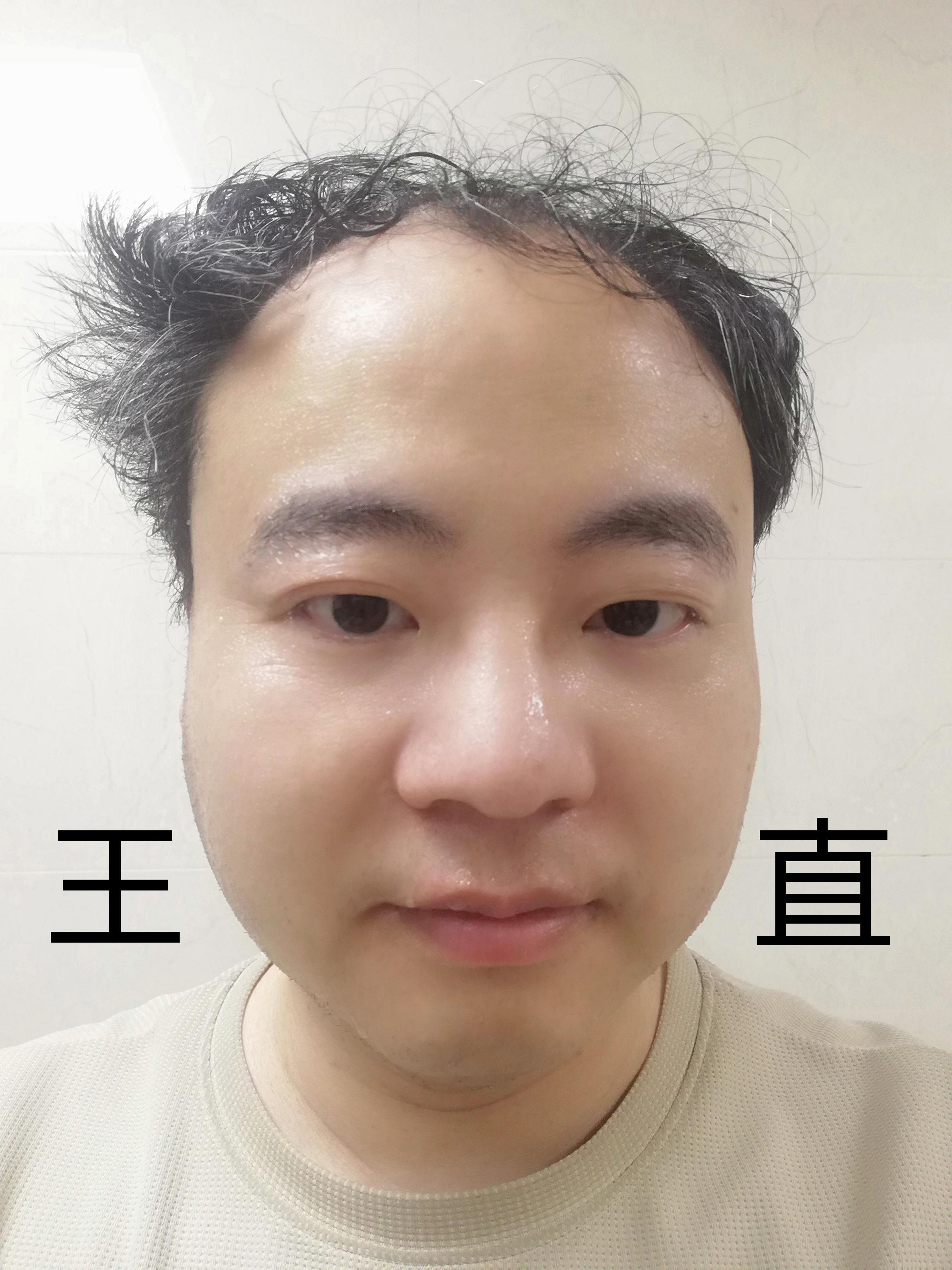 王直海贼团